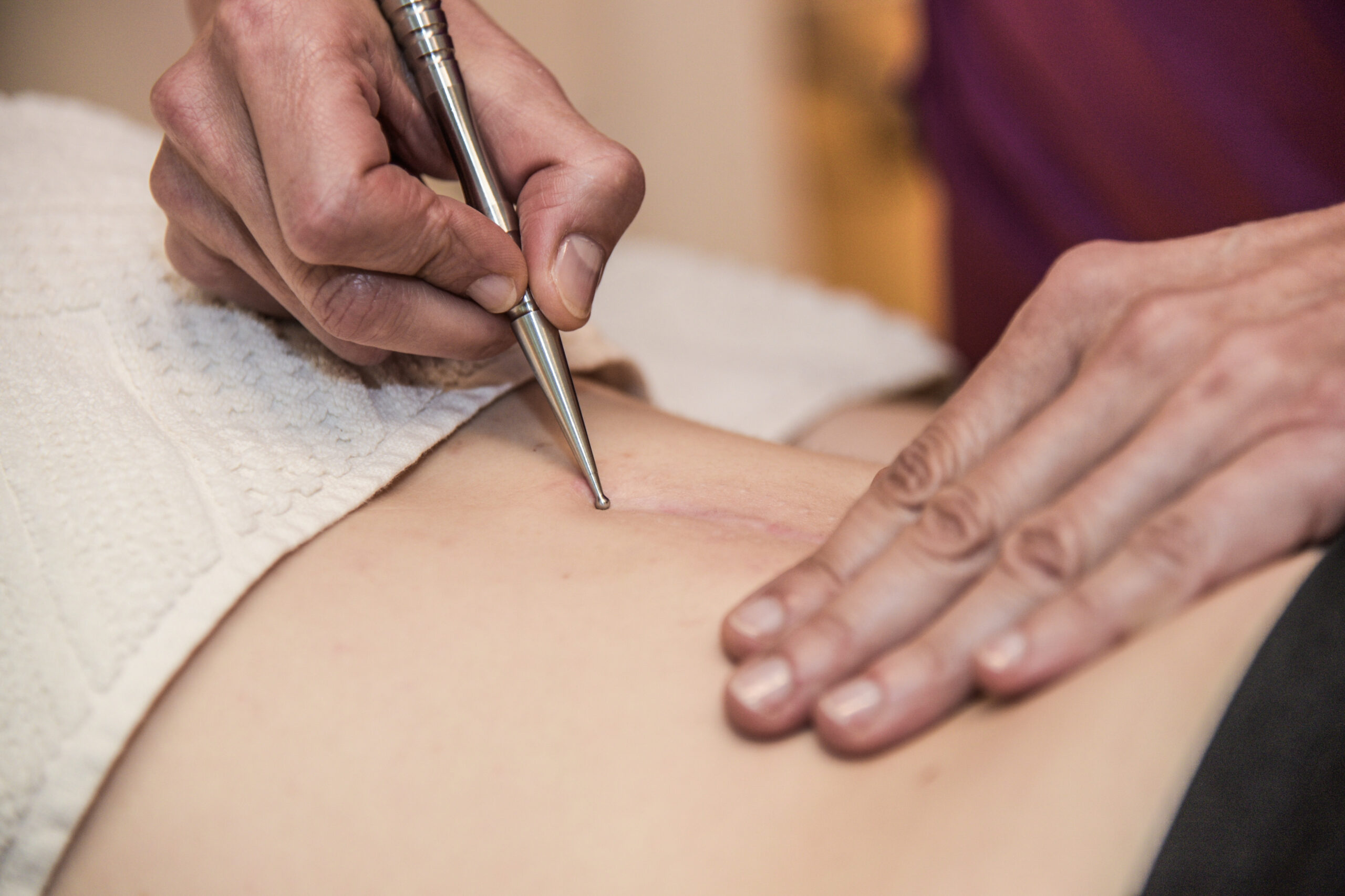 Physiotherapeutin behandelt Narbe am unteren Rücken
